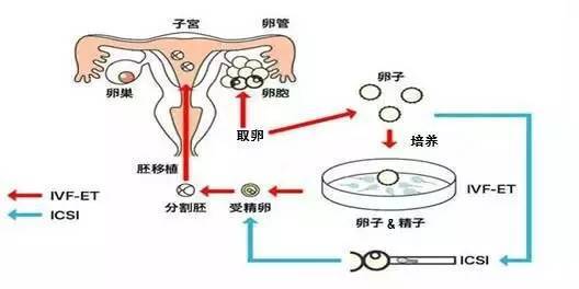 嘉兴一代试管